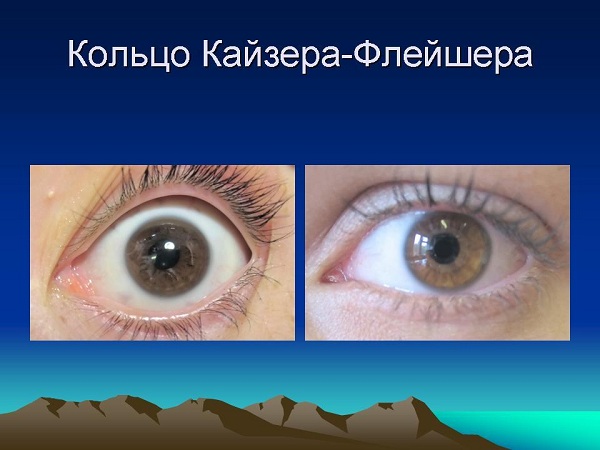 Клиника глазных болезней коновалова