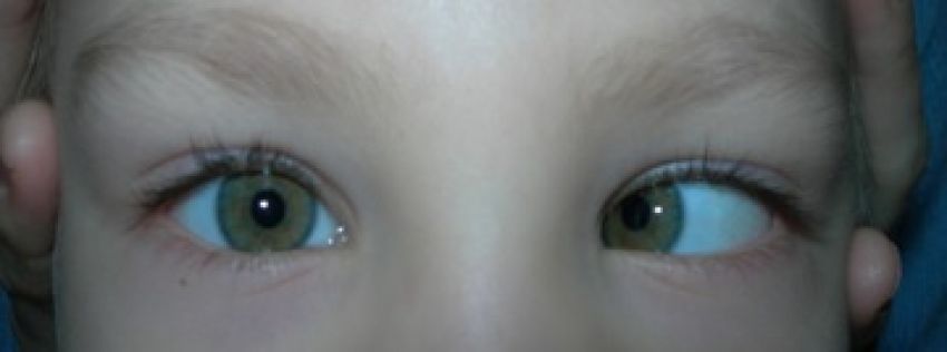 Лечение глаз у детей в рязани