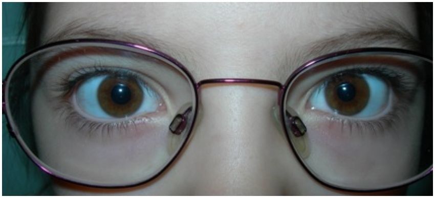 Лечение глаз у детей в рязани