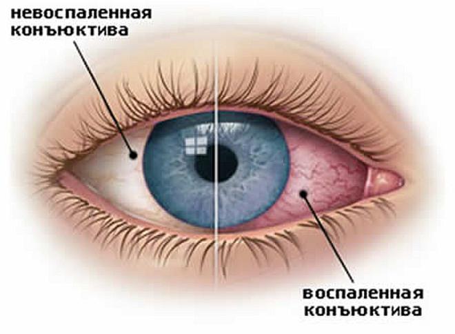 Центр глазных болезней на тверской 12