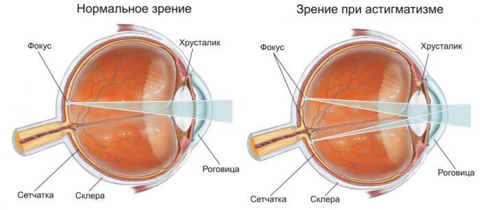 Центр глазных болезней на тверской 12