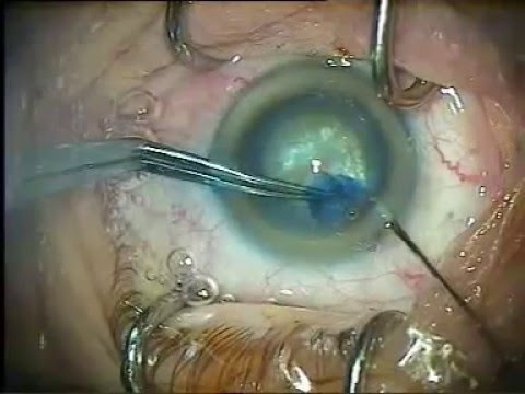 Глазная клиника три з ессентуки