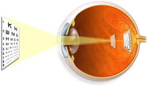 Какие лучше детская глазная клиника в москве по астигматизму
