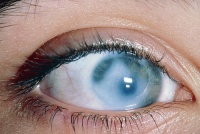 Тучково глазной центр контакты