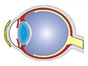 Операция на глазах от близорукости в воронеже