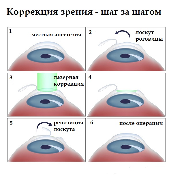 Клиника глазной хирургии федорова