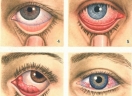 Клиника по лечению глаз в тюмеги