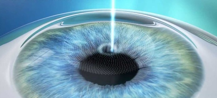 Клиника глаза в караганде астигматизм цены на операцию