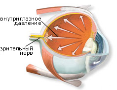 Клиники киева оперирующие катаракт глаза и глаукому