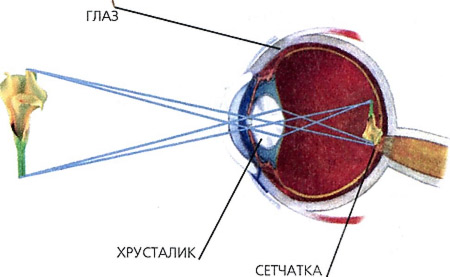 Глазные болезни на россолимо катаракта операции