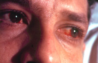 Клиника глазных болезней на маяковской