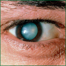 Клиника глазных болезней в киеве областная
