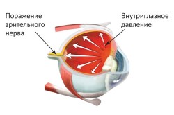 Больница по восстановлению зрения